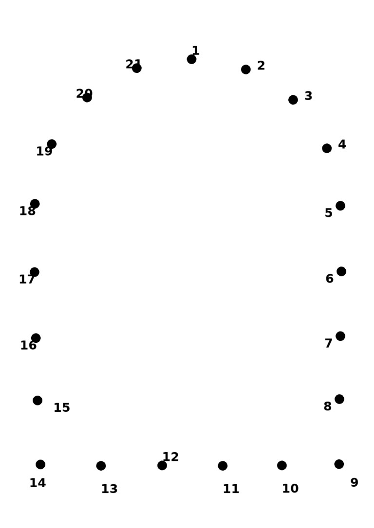 Treasure Chest Dot-to-Dot Puzzle — Free Printable